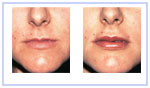 Lips