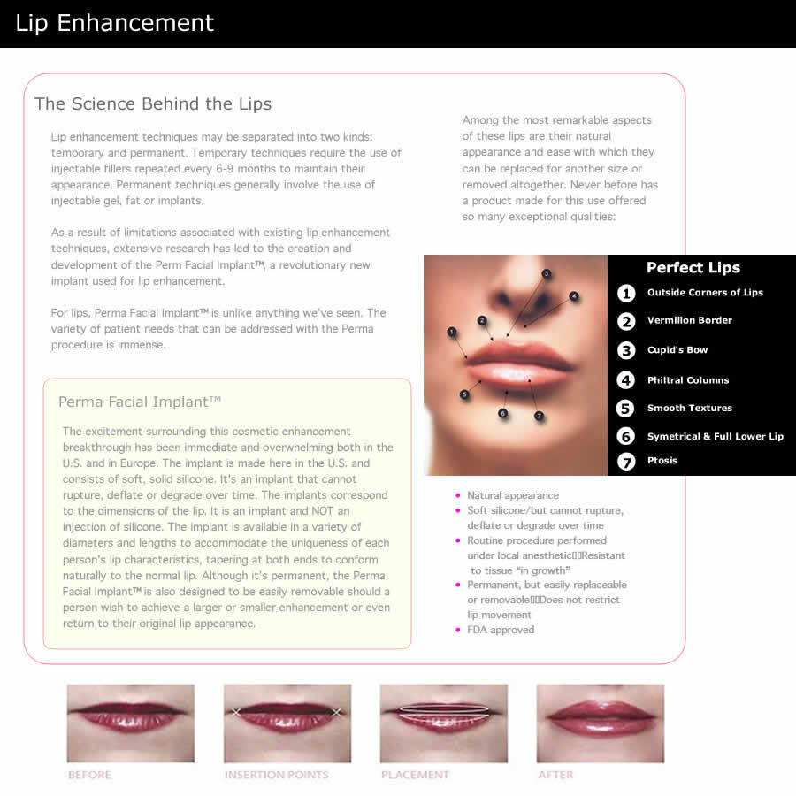 Perma Facial Implants for Lips in San Francisco, CA