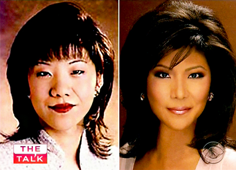 Julie Chen, Eyelid Surgery in Oakland, CA