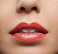 Lip Augmentation in Oakland, CA