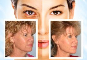 Facial Plastic Surgery in Oakland